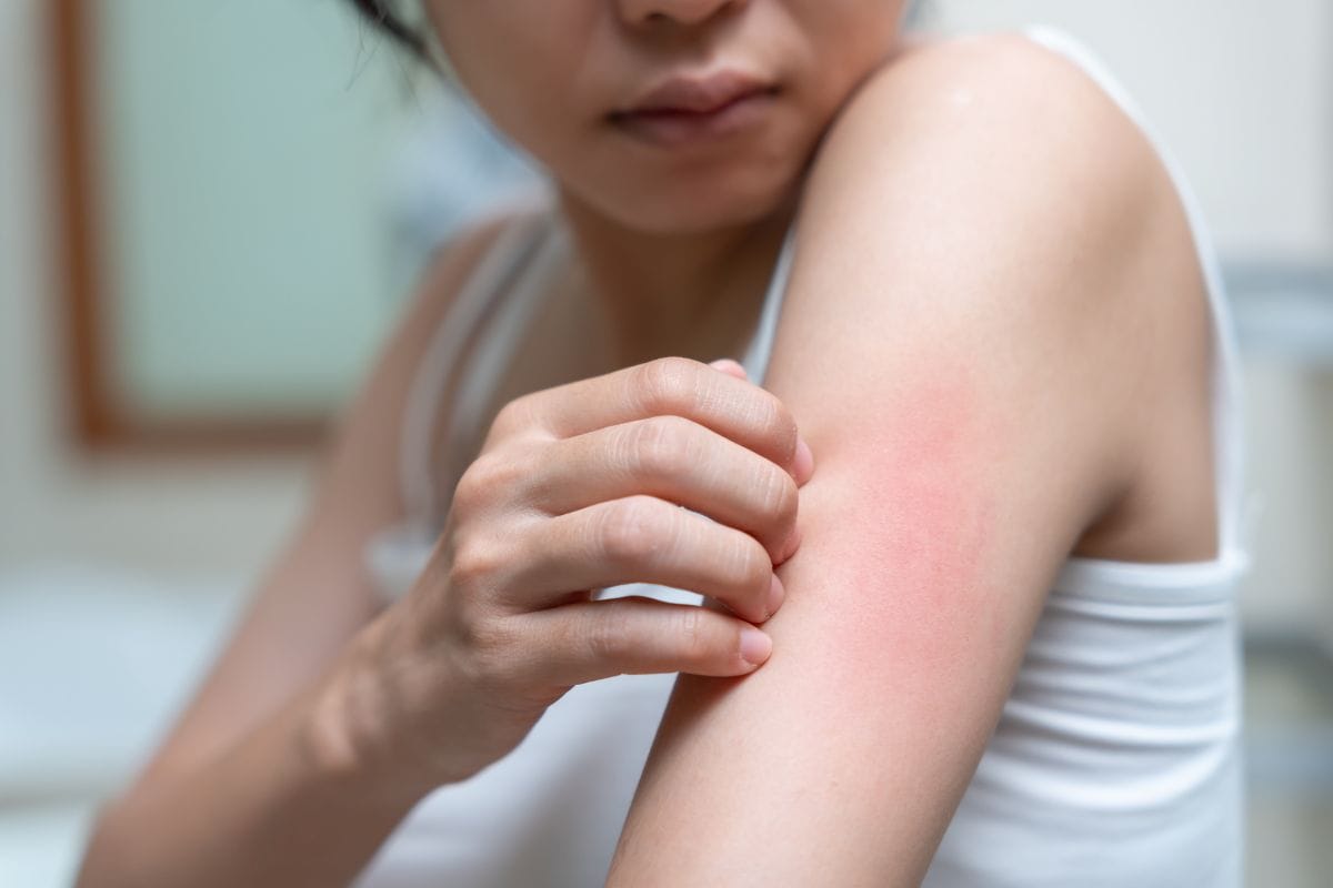 Skin Problem