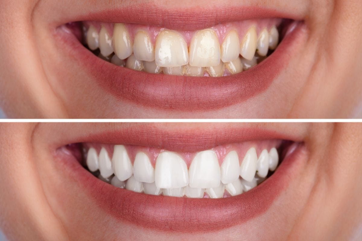 Teeth