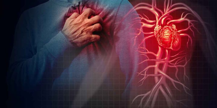 Does Workout Cause Heart Attack? Discovering The Truth