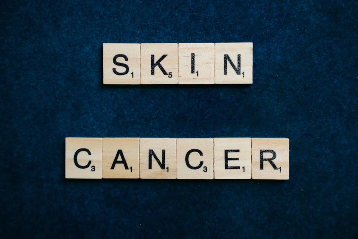 Guide to Skin Cancer Awareness