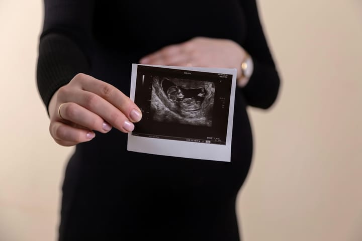 Image of a pregnant woman 